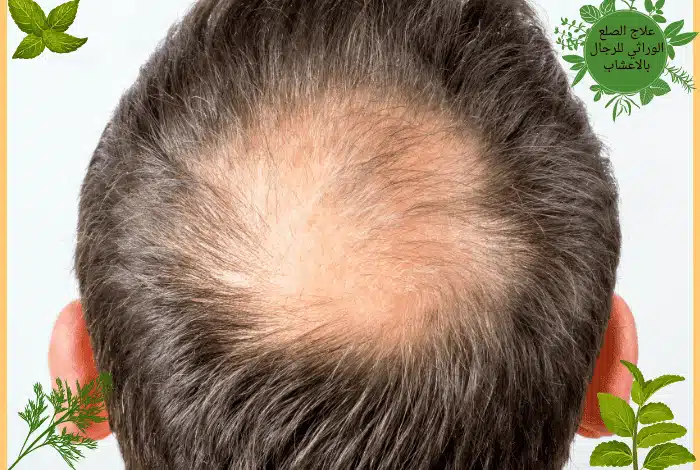 Alpecin caffeine liquid 